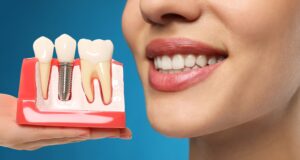 Dental Implants West Bloomfield