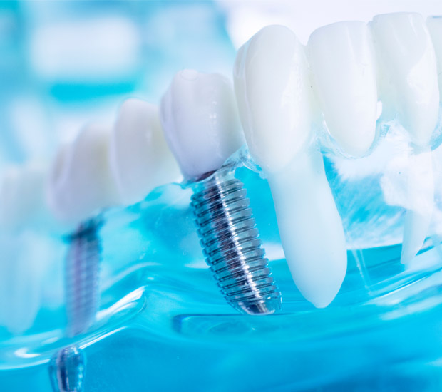 West Bloomfield Township Will I Need a Bone Graft for Dental Implants