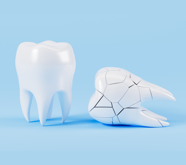 West Bloomfield Township What Should I Do If I Chip My Tooth