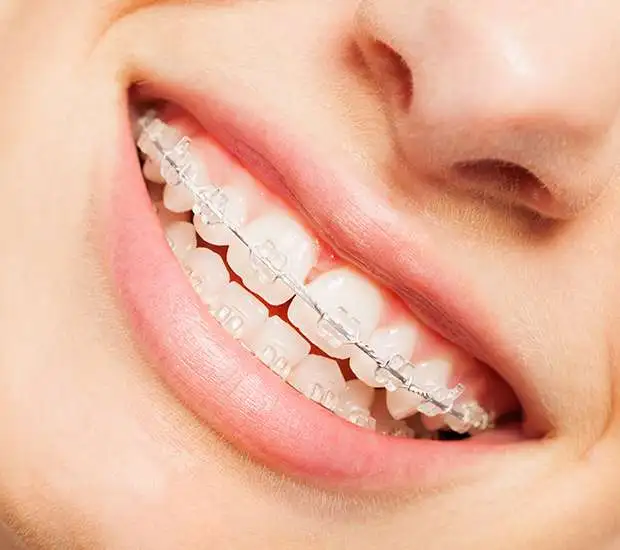 West Bloomfield Township Clear Braces