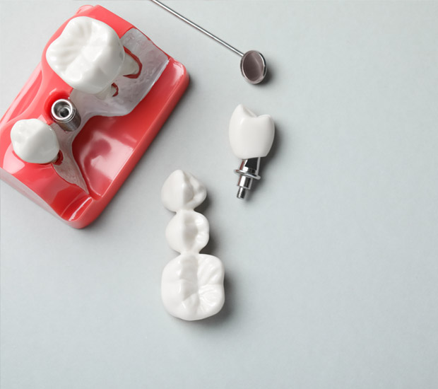 West Bloomfield Township The Difference Between Dental Implants and Mini Dental Implants