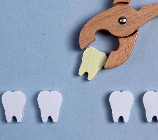 West Bloomfield Township Tooth Extraction